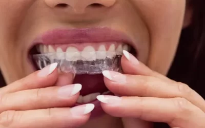 Invisalign Reseda: Clear Aligner Therapy for Discreet Orthodontic Correction